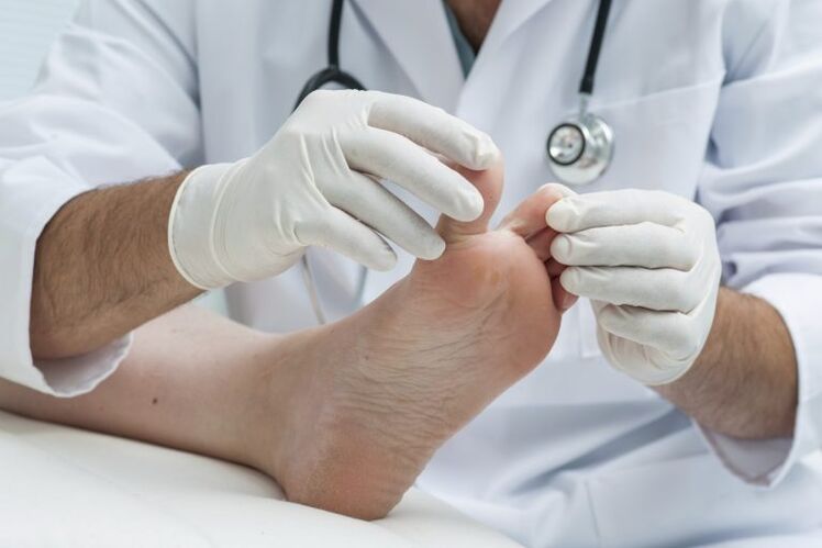 The doctor examination through the presence of mycosis