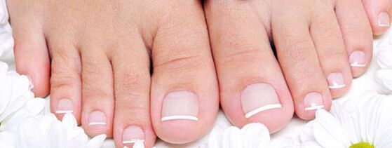 What is a nail fungus
