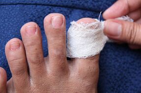 Nail -nail